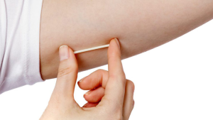 The contraceptive implant: common side effects and reviews­