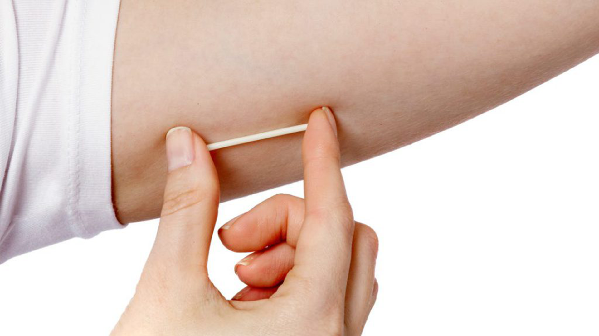 Common Contraceptive Implant Side Effects The Lowdown