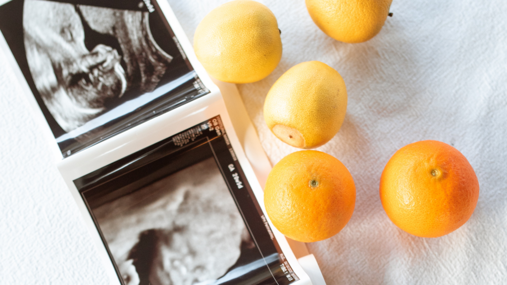 Sonogram and Oranges and Lemons
