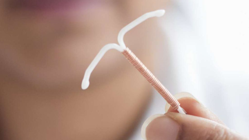 Hormonal IUD (Mirena) - Mayo Clinic